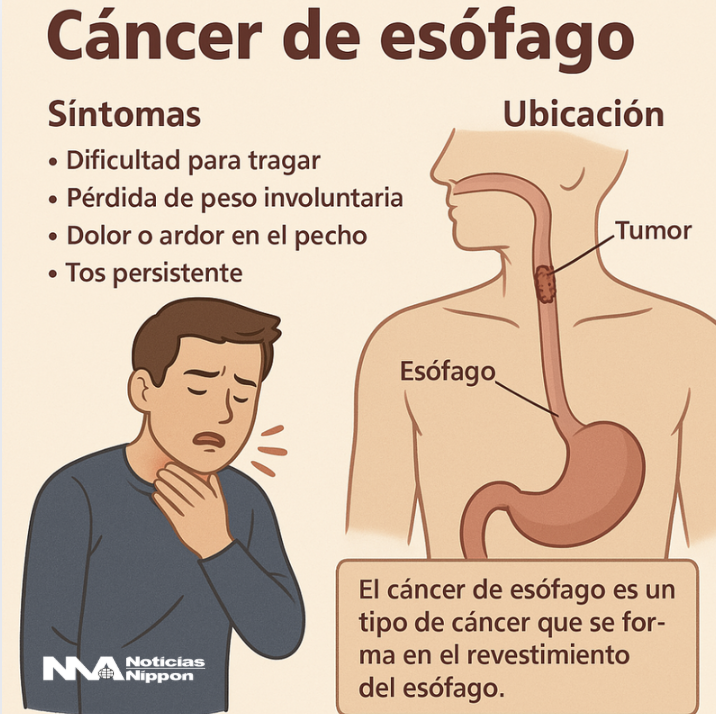[shokudōgan] Ishibashi revela que tiene cáncer – Noticias Nippon